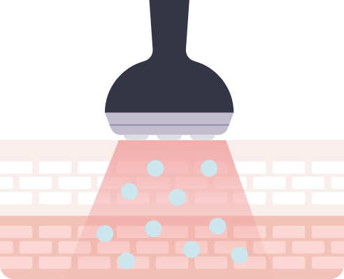 エレクトロポレーション